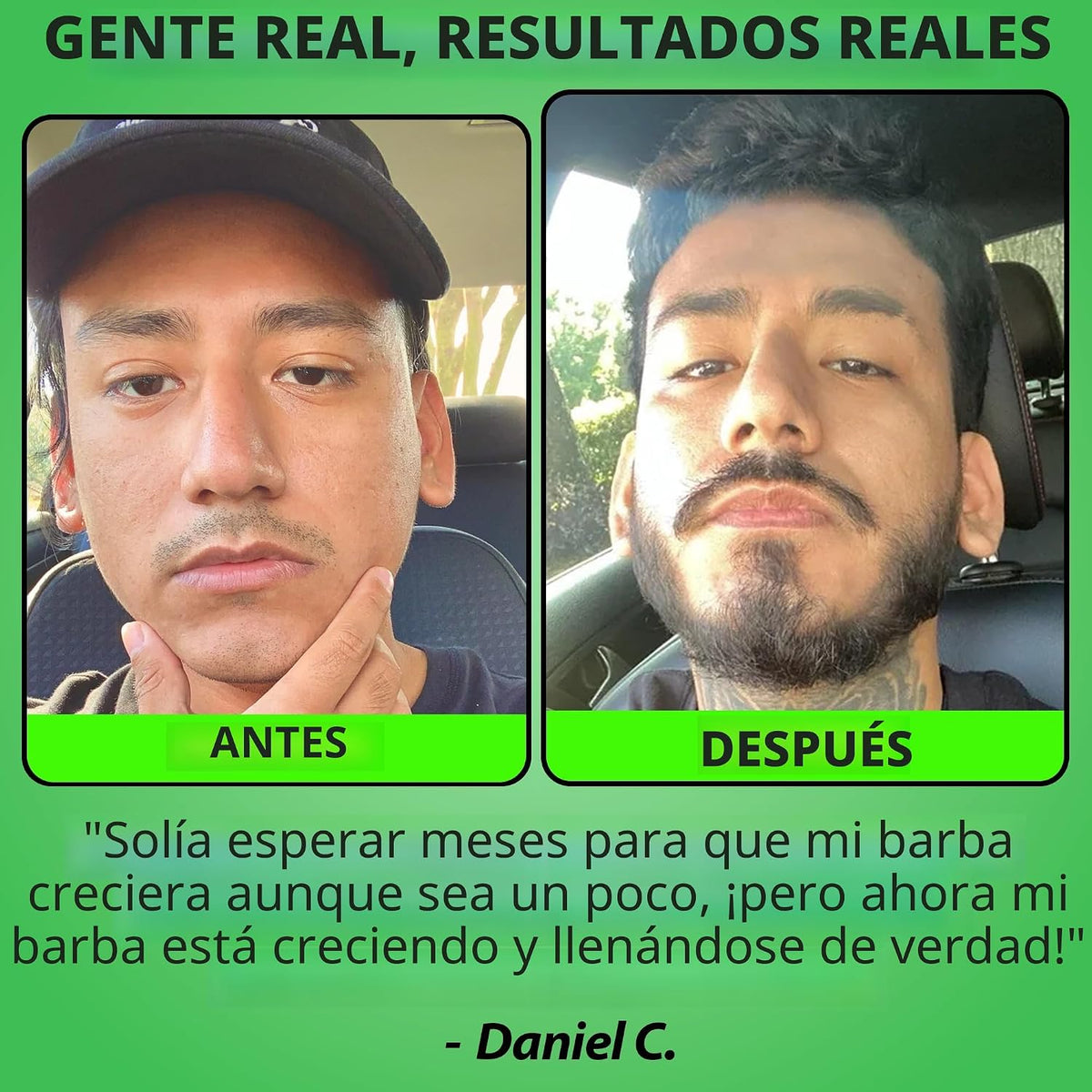 GROW XXL - Paquete de crecimiento de barba - Aceite de crecimiento...