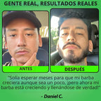 Beard GROW XXL y paquete de minoxidil para barba para hombres, acei...