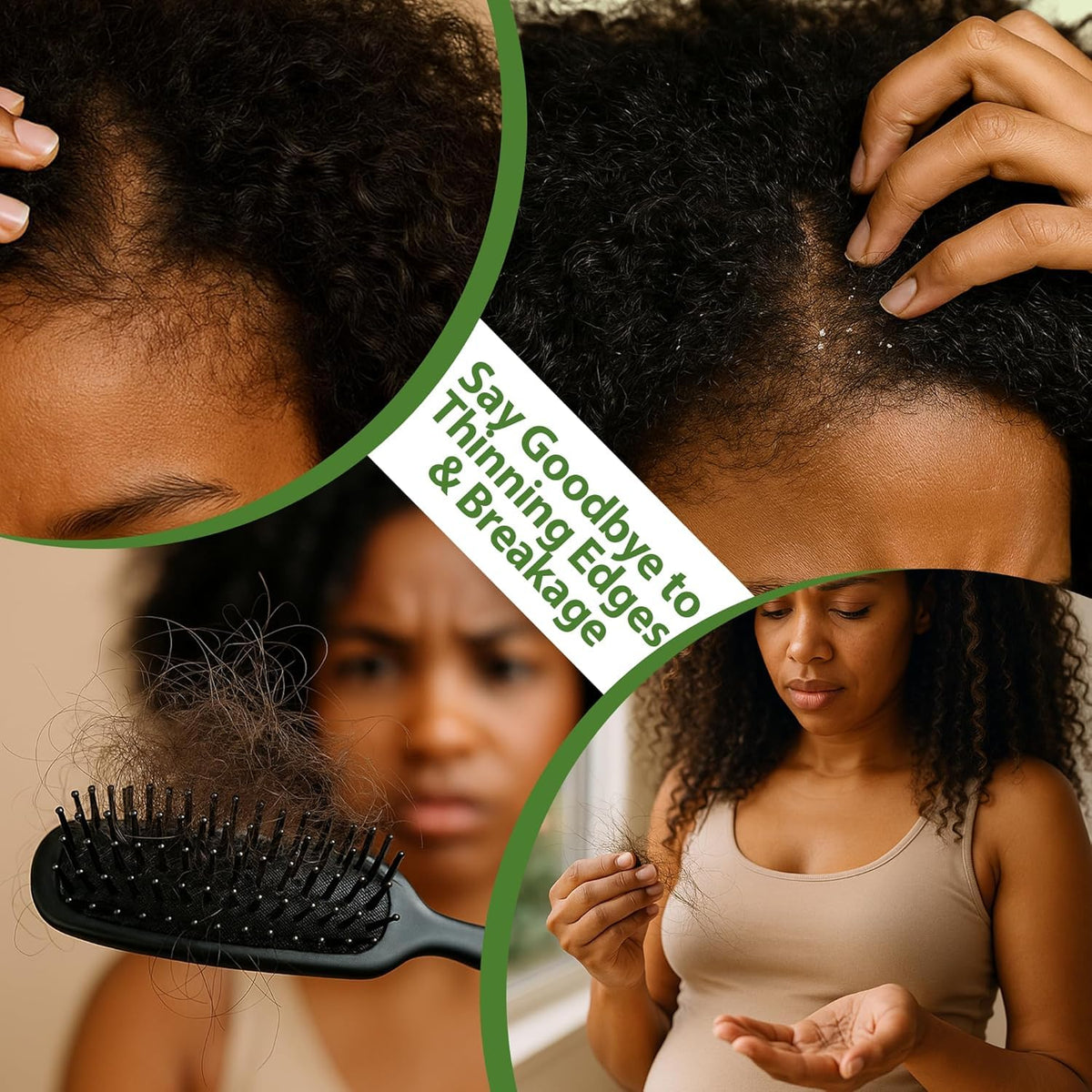 LIFEWITQUEENP Aceite de crecimiento para el cuidado del cabello, ac...