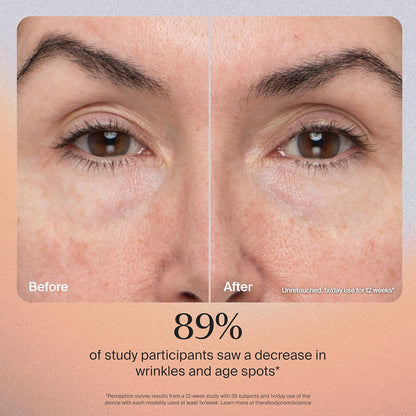 TheraFace Therabody TheraFace PRO - Dispositivo facial de microcorr...