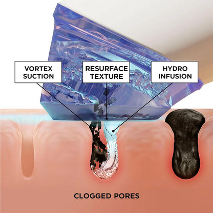 BeautyBio GLOfacial Hydro-Infusion Deep Pore Cleansing + Blue LED C...