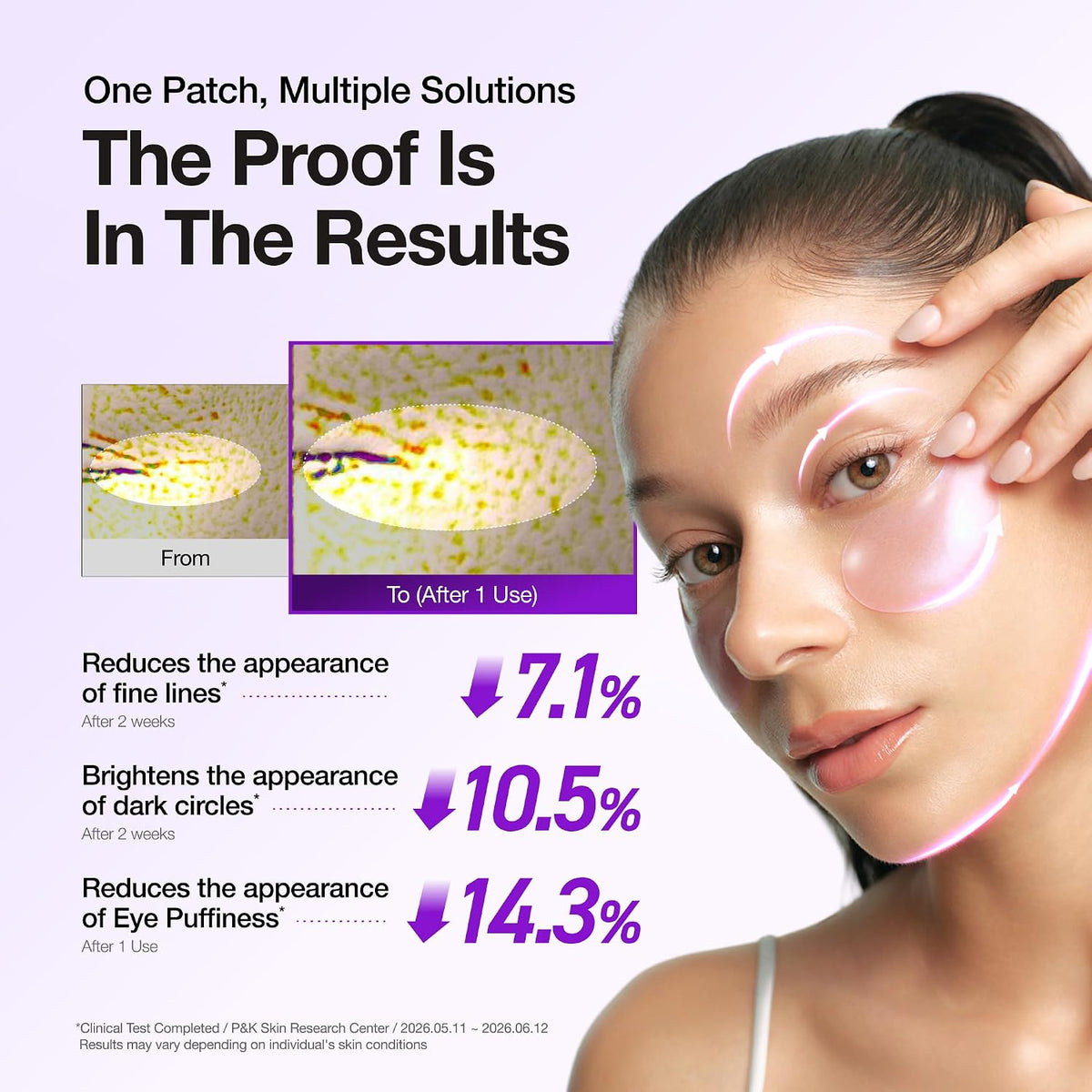 ANUA Parches para Ojos Retinol Berry, 60 unidades | Máscara de hidr...