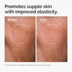 The Ordinary Set favorito de suero – Ácido hialurónico 2% + B5, niacinamida 10% + zinc 1%, solución de cafeína 5% – Sueros para ojos y cara para hidratar, aclarar y minimizar los poros cuidado de la piel