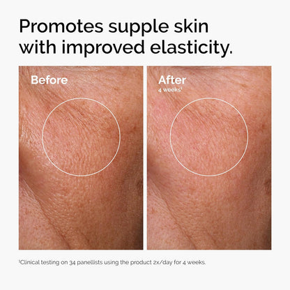 The Ordinary Set favorito de suero – Ácido hialurónico 2% + B5, niacinamida 10% + zinc 1%, solución de cafeína 5% – Sueros para ojos y cara para hidratar, aclarar y minimizar los poros cuidado de la piel