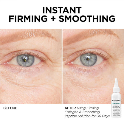 BeautyBio GLOfacial Hydro-Infusion Deep Pore Cleansing + Blue LED C...
