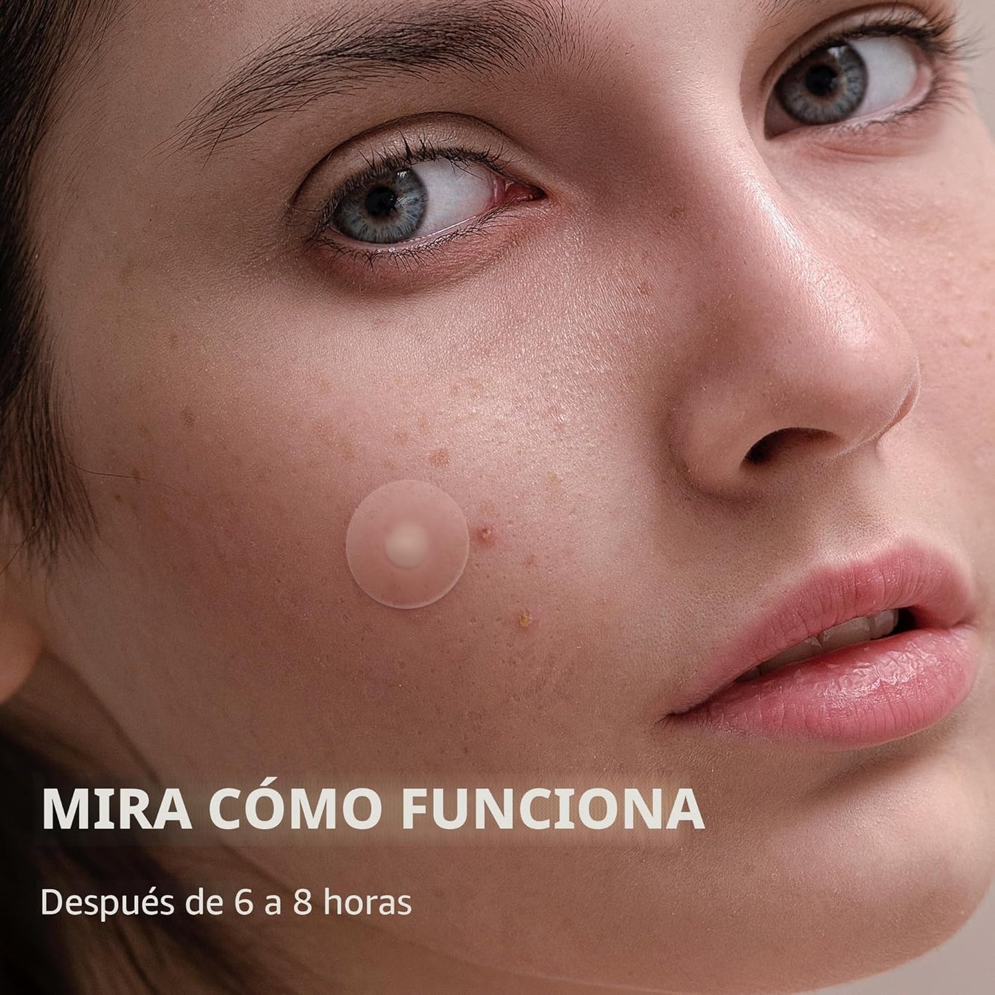 Daolyo - Parches para espinillas para la cara, 4 tamaños 300 unidad...
