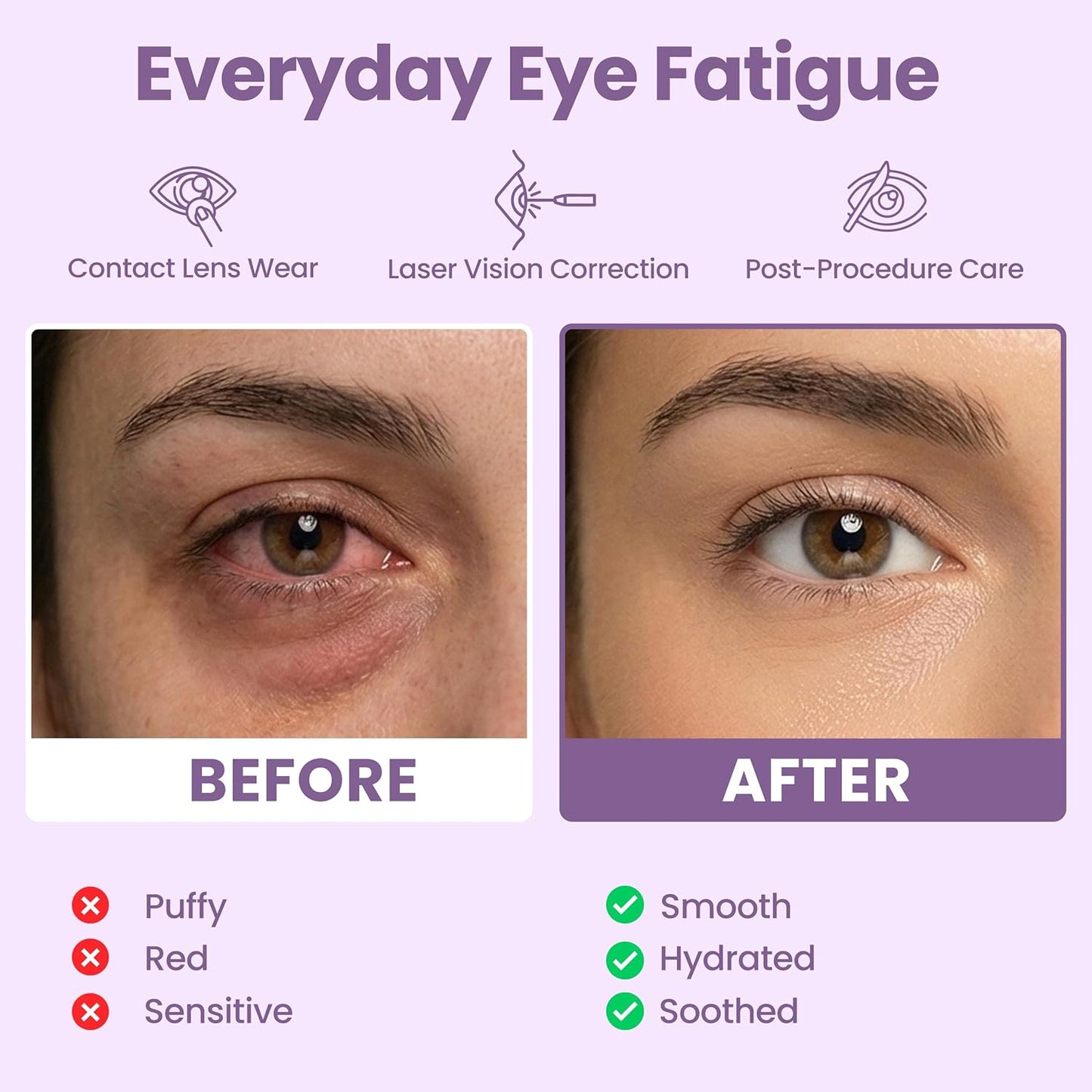 Lure Essentials Compresa cálida autocalentable para ojos secos, más...