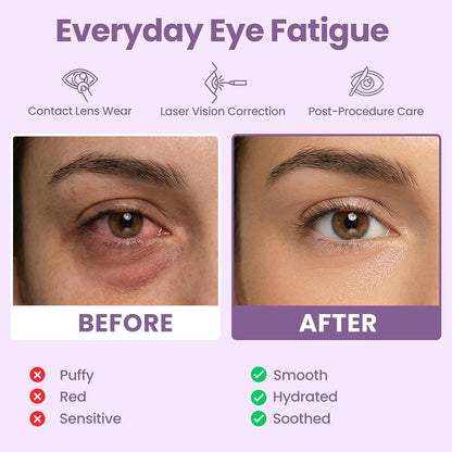 Lure Essentials Compresa cálida autocalentable para ojos secos, más...