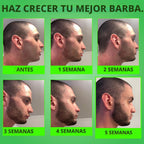 Beard GROW XXL y paquete de minoxidil para barba para hombres, acei...