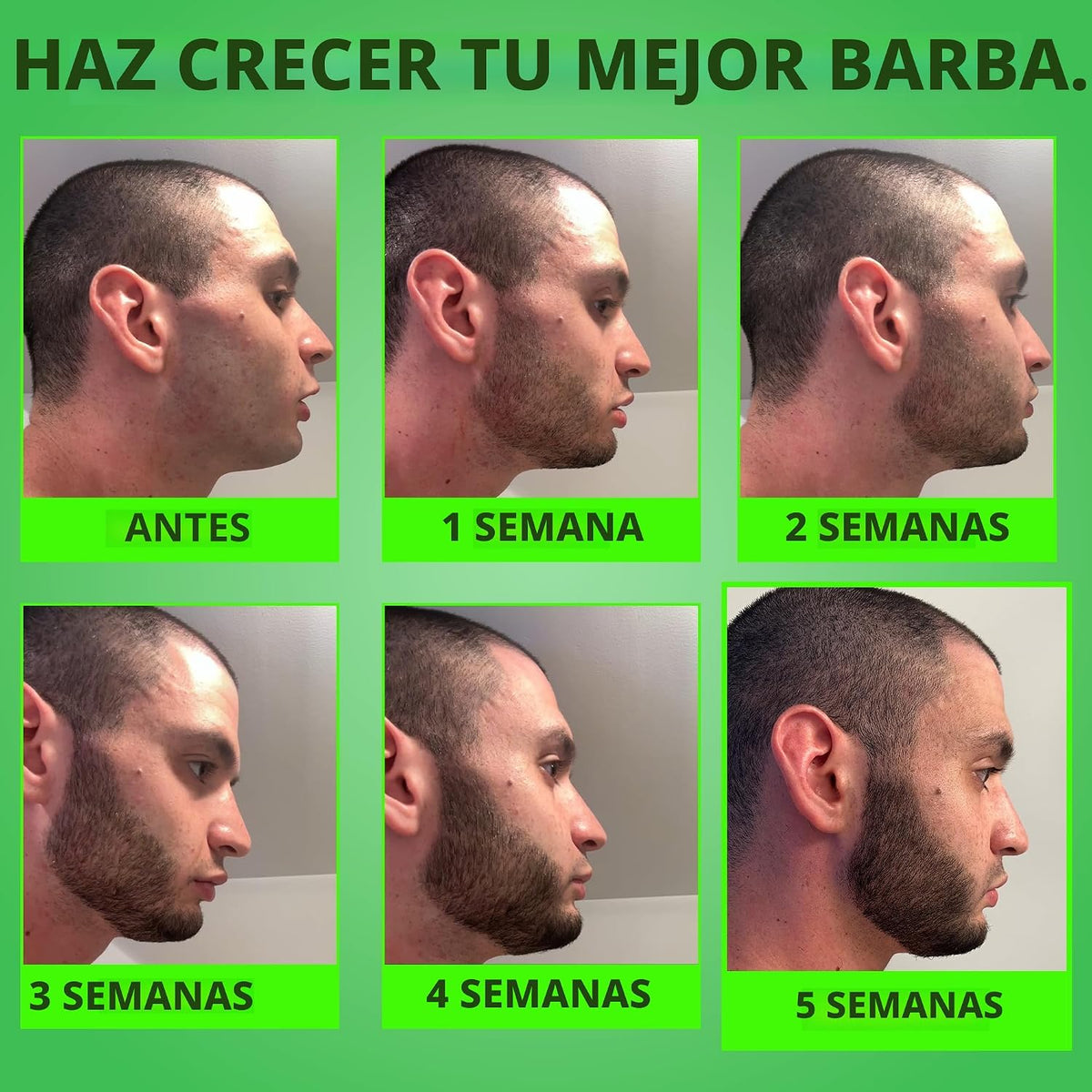 Beard GROW XXL y paquete de minoxidil para barba para hombres, acei...