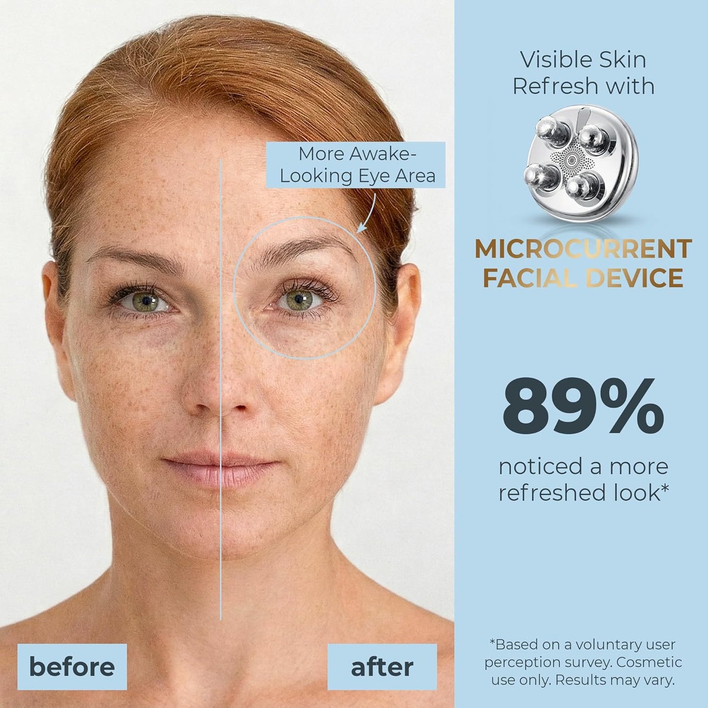 DEZALON Dispositivo facial de microcorriente, herramienta de masaje...
