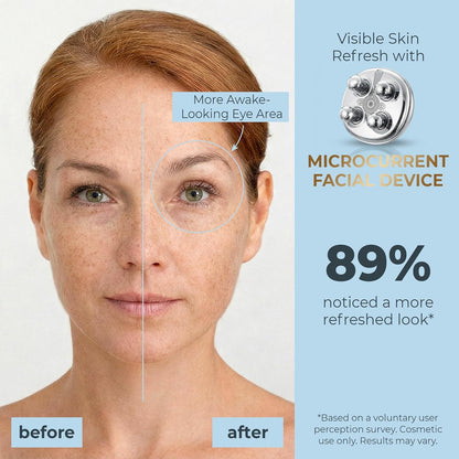 DEZALON Dispositivo facial de microcorriente, herramienta de masaje...
