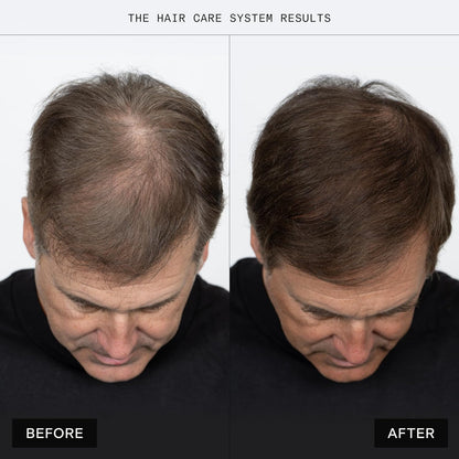 Caldera + Lab The Shampoo | Champú para hombres para cabello sano, limpiador diario sin sulfato, probado dermatológicamente, todo tipo de cabello