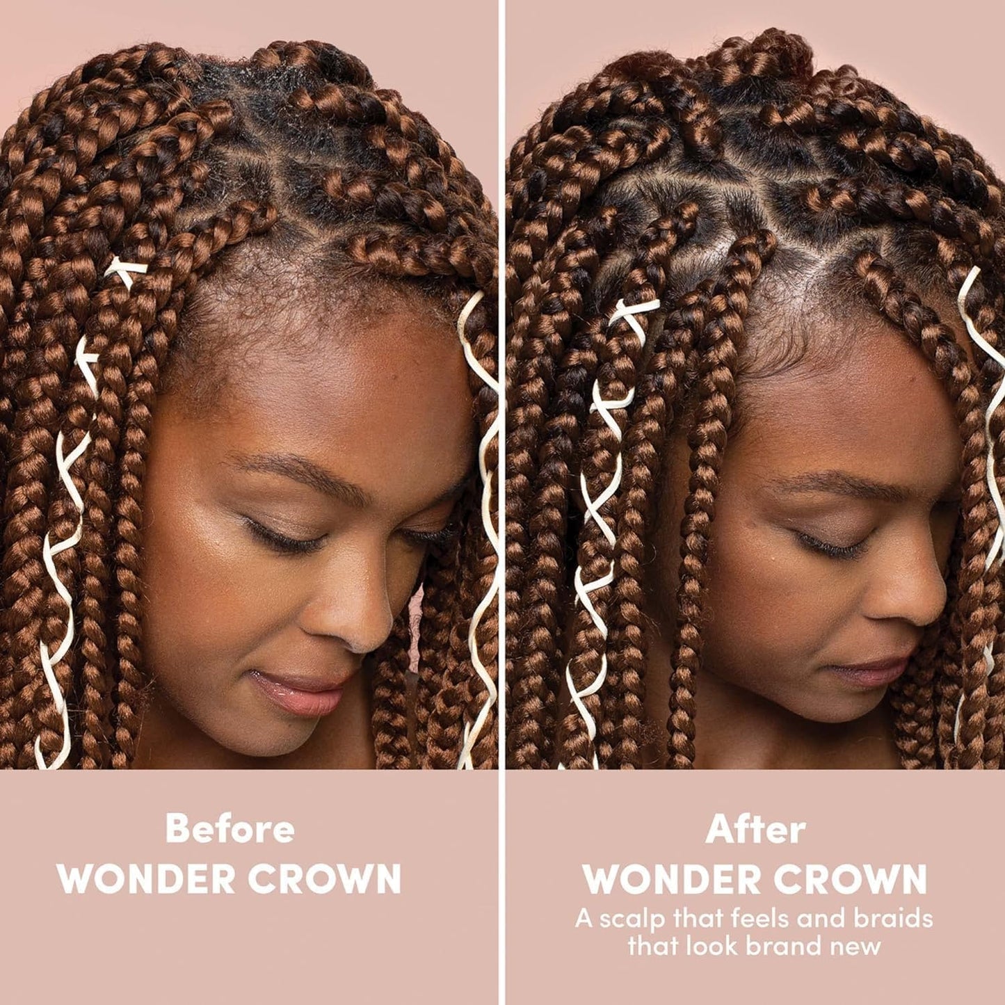 Mizani Wonder Crown - Limpiador de cuero cabelludo | Tratamiento de cuero cabelludo seco y caspa | Ayuda a estimular el crecimiento del cabello | Con aceite de árbol de té y menta | Para cuero cabelludo seco con picazón | 6.8 onzas líquidas