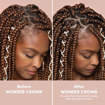 Mizani Wonder Crown - Limpiador de cuero cabelludo | Tratamiento de cuero cabelludo seco y caspa | Ayuda a estimular el crecimiento del cabello | Con aceite de árbol de té y menta | Para cuero cabelludo seco con picazón | 6.8 onzas líquidas