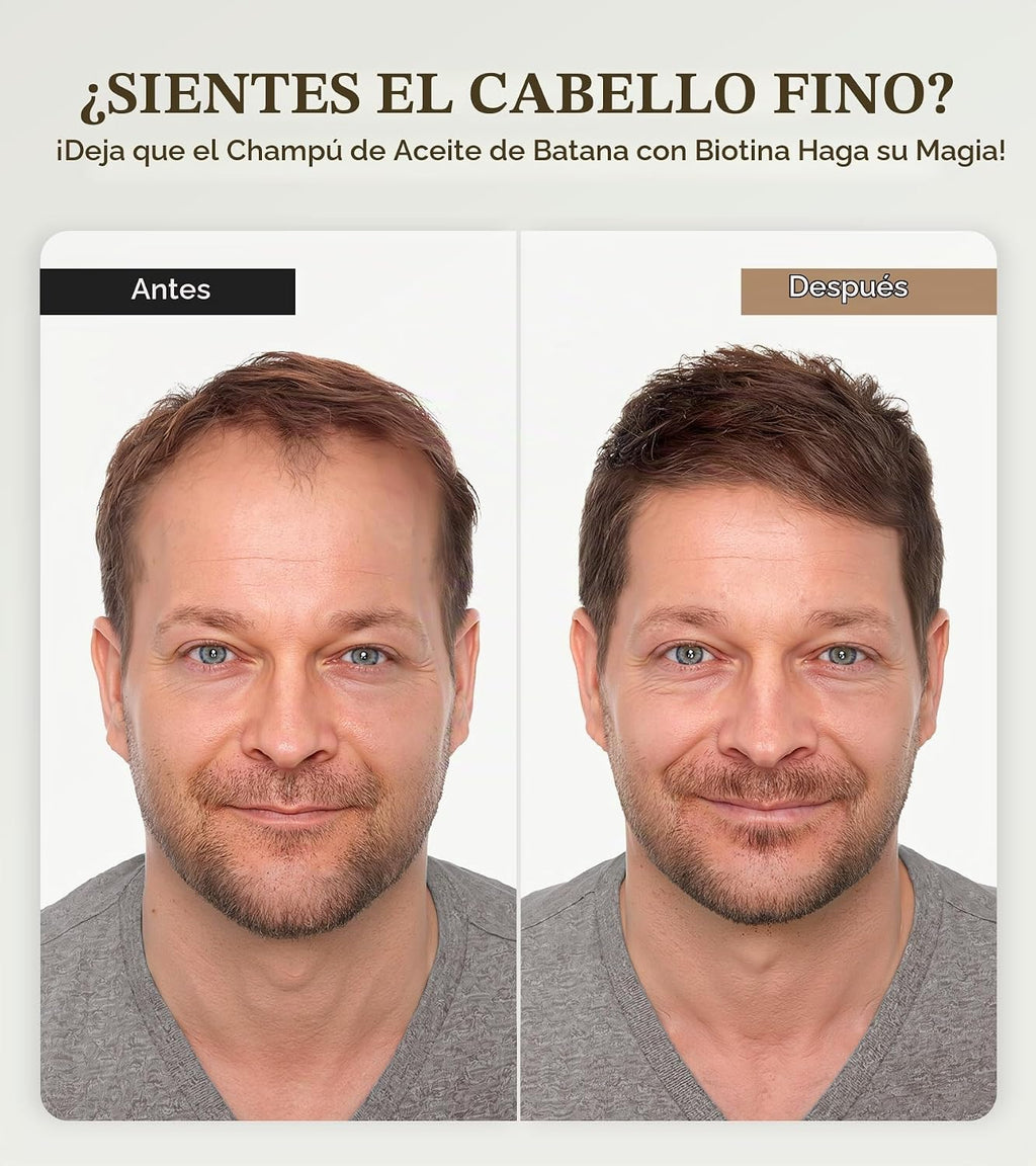 Champú de biotina para un crecimiento del cabello 3 veces más rápid...