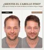 Champú de biotina para un crecimiento del cabello 3 veces más rápid...