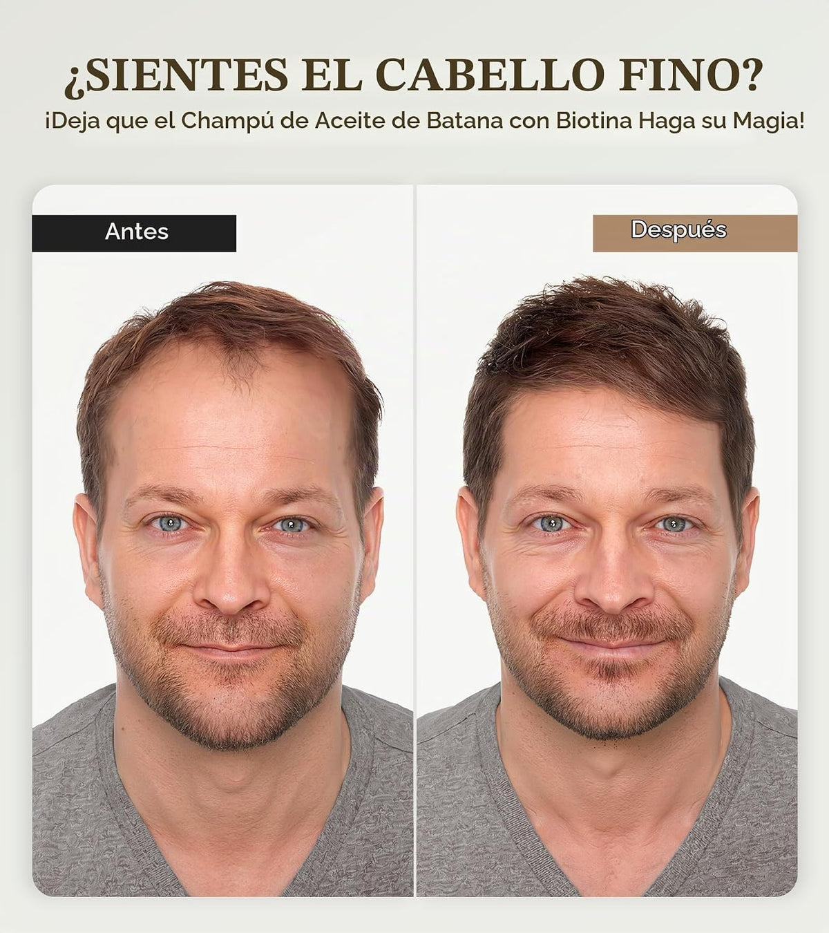 Champú de biotina para un crecimiento del cabello 3 veces más rápid...