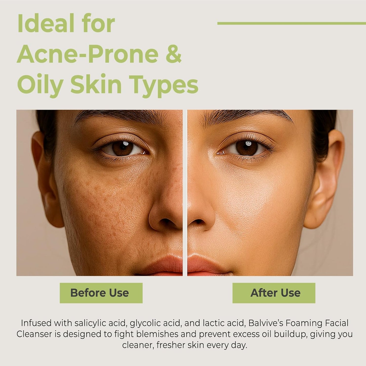 Limpiador facial espumoso con ácido salicílico, ácido glicólico, ácido láctico y extracto de té verde, lavado facial para acné, piel grasa y sensible, removedor de maquillaje y cuidado de la