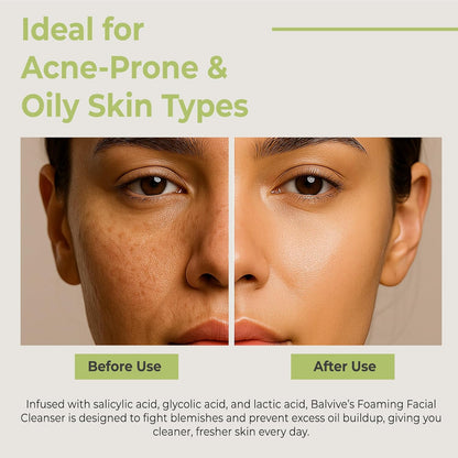 Limpiador facial espumoso con ácido salicílico, ácido glicólico, ácido láctico y extracto de té verde, lavado facial para acné, piel grasa y sensible, removedor de maquillaje y cuidado de la