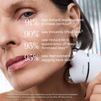 NuFACE Trinity+ Kit de Dispositivo Facial de Microcorriente \u2013...