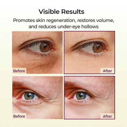 Dr.Melaxin Cemenrete Calcio Multi Bálsamo 9g Cuidado de la Piel Coreano Todo en Uno Calcio Stick Colágeno Arrugas Tratamiento Facial y de Ojos Bálsamo