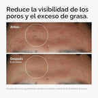 The Ordinary Niacinamide 10% + Zinc 1%, Smoothing Serum for Blemish...