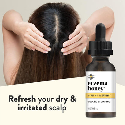 ECZEMA HONEY Aceite calmante para el cuero cabelludo, aceite natural de miel para el cabello y cuidado del cuero cabelludo, suero diario para aliviar la picazón del cuero cabelludo, el tratamiento del