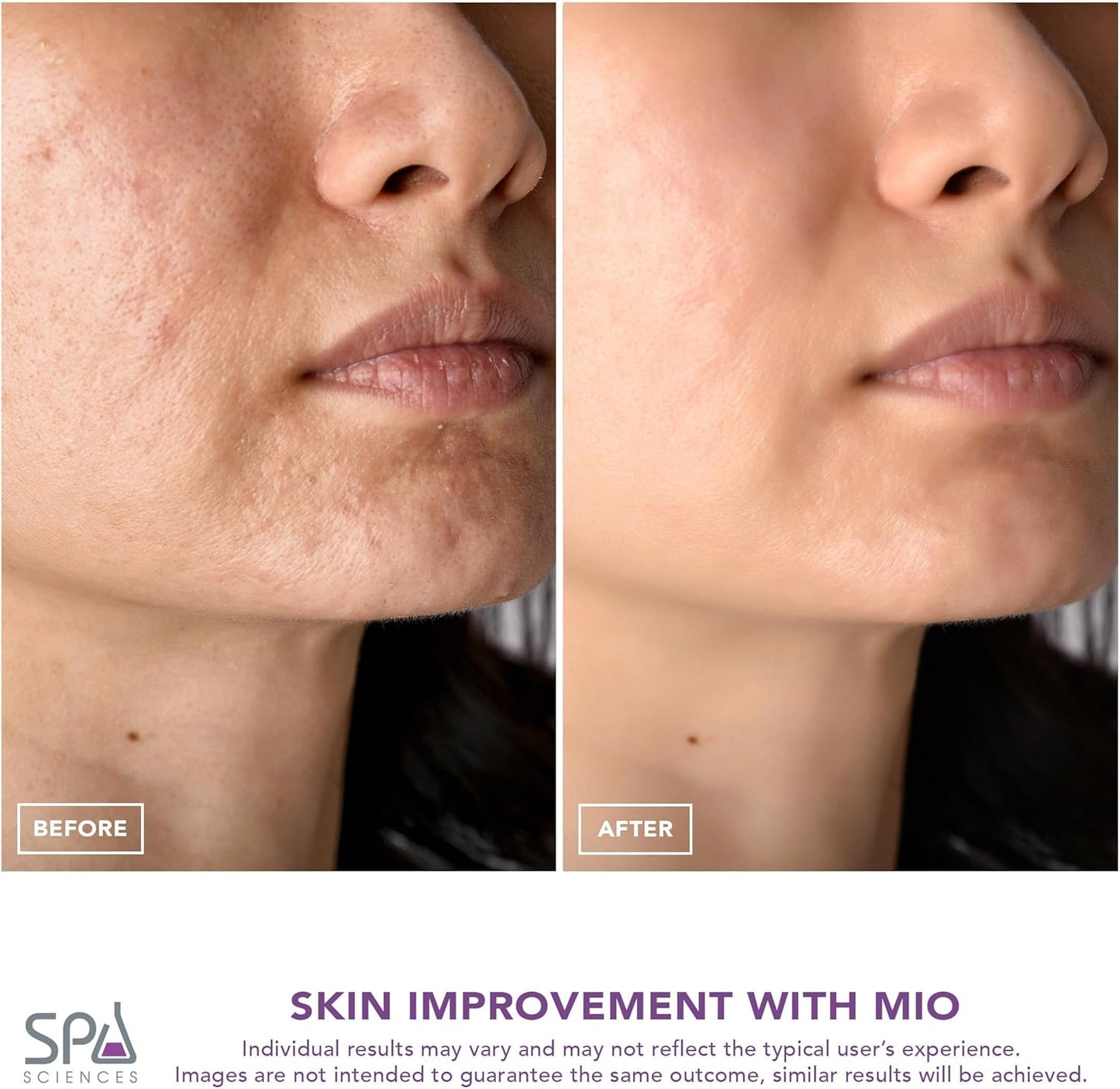 Spa Sciences MIO Diamond Microdermabrasion - Removedor de puntos ne...