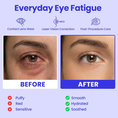 Máscara de ojos de vapor de Eye Serenity con autocalentamiento, com...
