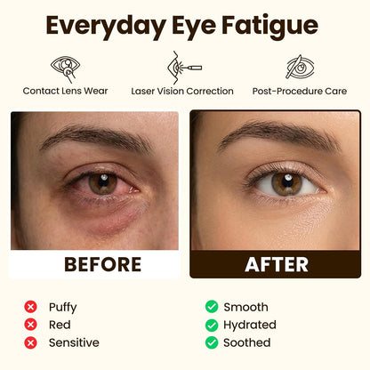 Lure Essentials Compresa cálida autocalentable para ojos secos, más...