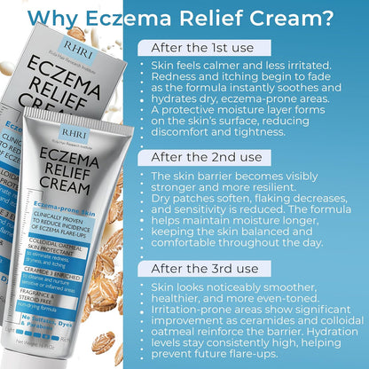 Crema para eccema para adultos con avena coloidal | Tratamiento de eccema para piel seca con picazón | Alivia el enrojecimiento de la picazón y la descamación | Hidratante calmante para pieles