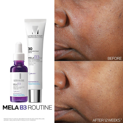 La Roche-Posay Mela B3 Serum, Dark Spot Corrector With Anti-Aging M...