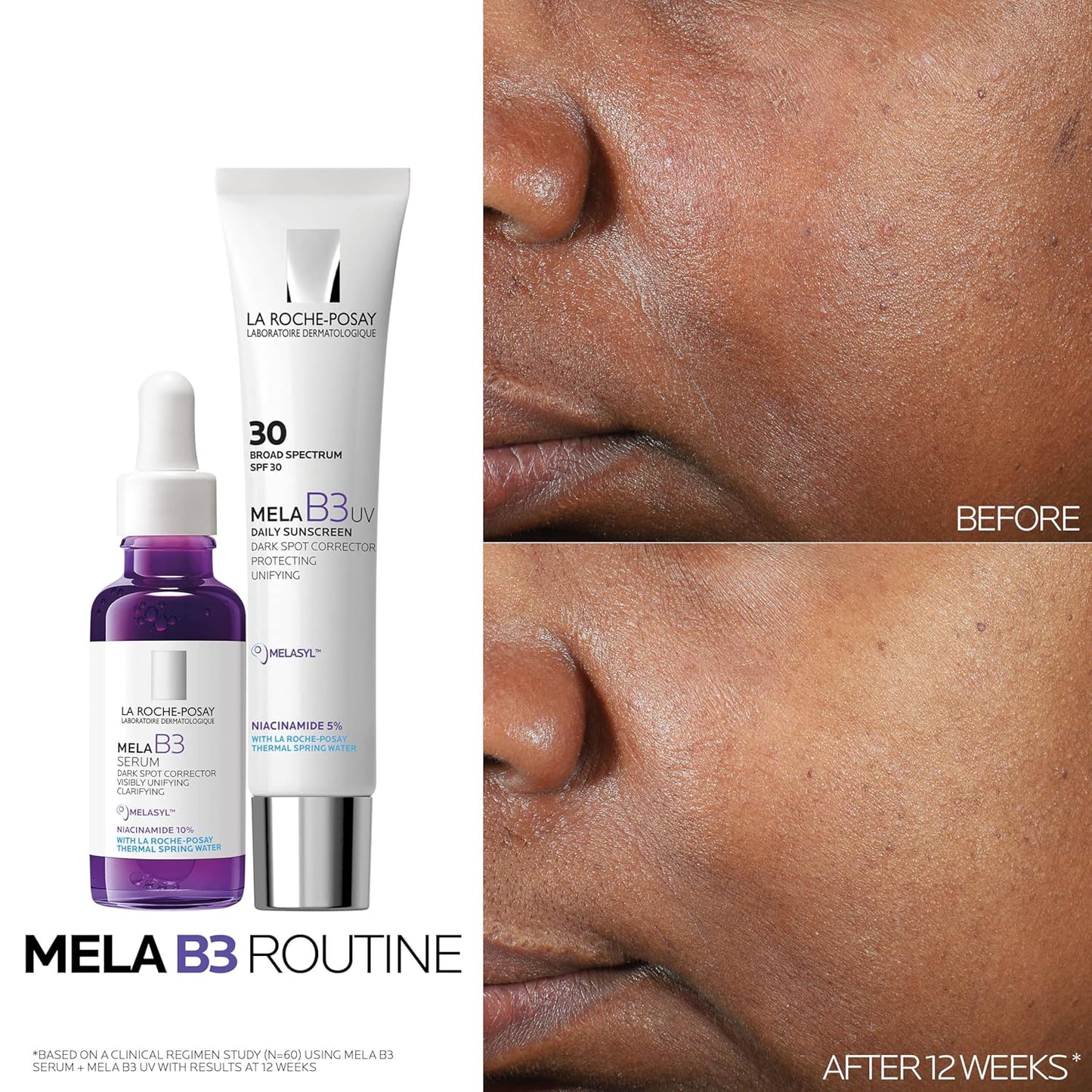 La Roche-Posay Mela B3 Serum, Dark Spot Corrector With Anti-Aging M...