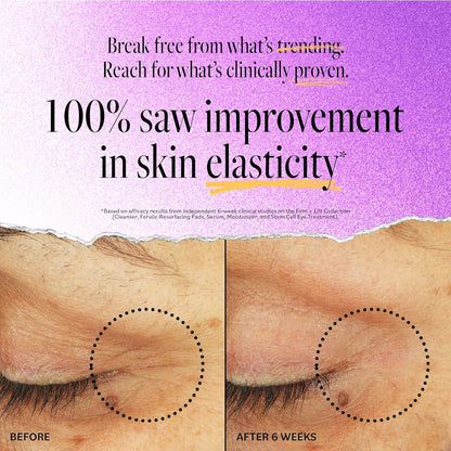 Derma E Tratamiento de Ojos con Células Madre para Levantar – Crema Multi-Acción para Reafirmar y Reducir Arrugas para Bajo los Ojos y Párpados Superiores - Hidratante y Revitalizante, 14g