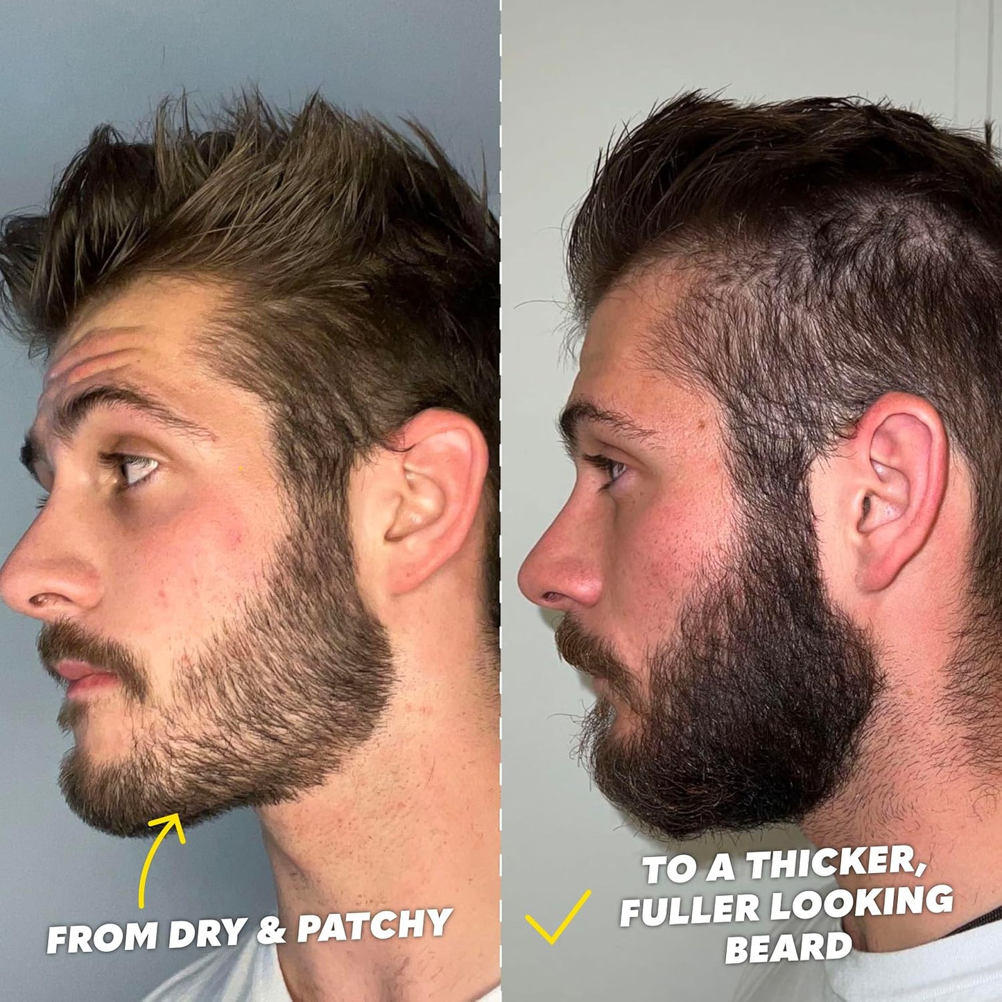 The Beard Club Kit de crecimiento de barba Signature \u2013 Rodillo...