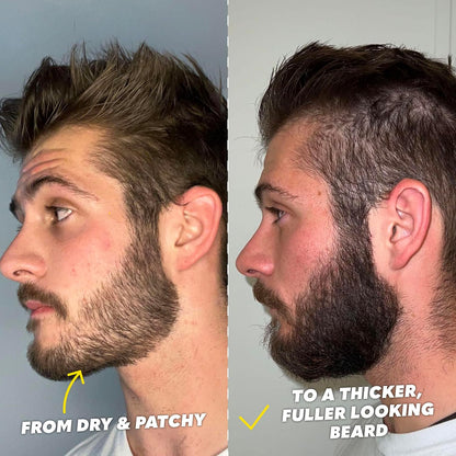 The Beard Club Kit de crecimiento de barba Signature \u2013 Rodillo...