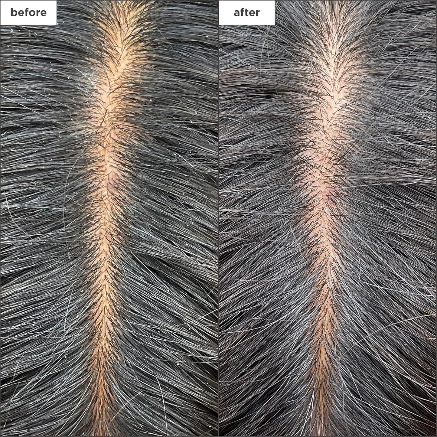 Briogeo Scalp Revival Charcoal + Tea Tree - Mascarilla refrescante para el cuero cabelludo | Tratamiento semanal del cuero cabelludo para cuero cabelludo seco, escamoso o con picazón | Desintoxicante