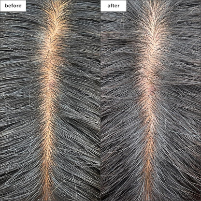 Briogeo Scalp Revival Charcoal + Tea Tree - Mascarilla refrescante para el cuero cabelludo | Tratamiento semanal del cuero cabelludo para cuero cabelludo seco, escamoso o con picazón | Desintoxicante