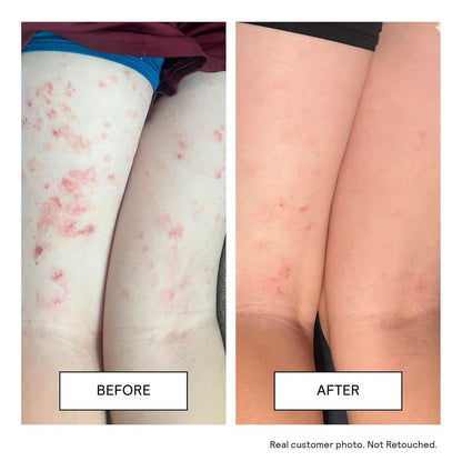 Untoxicated Crema Hidratante Facial Y Crema Corporal Para Pi