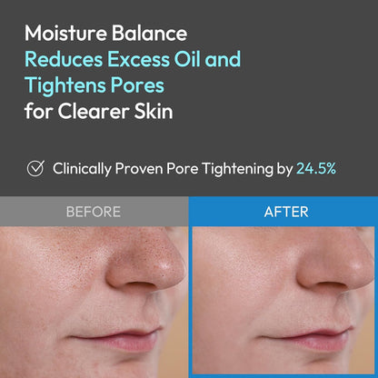 Aqua-gen All In One - Hidratante Facial Para Hombre, Crema