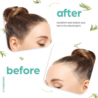 Artnaturals Aceite De Cabello Orgánico De Romero Y Ricino +
