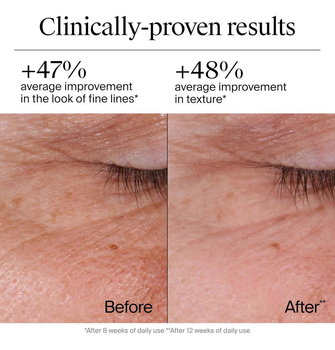Neutrogena - Hidratante Facial Rapid Wrinkle Repair Retinol,