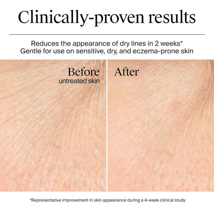 Neutrogena Hydro Boost - Crema De Gel Con Ácido Hialurónico,