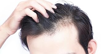 PURA D'OR Juego de champú y acondicionador de biotina para terapia contra el adelgazamiento del cabello, resultados eficaces PROBADOS CLÍNICAMENTE, productos para espesar el cabello para mujeres y