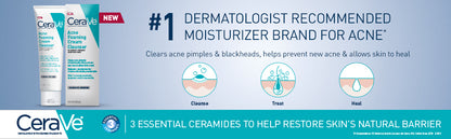 CeraVe Limpiador en crema espumosa para el acné, lavado facial de peróxido de benzoilo al 4% con ácido hialurónico, niacinamida y ceramidas, tratamiento diario suave para el acné para la cara